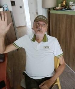 Corrado Chiostrini con il volto ferito dopo essersi tuffato sugli scogli al molo Scaglietti nella zona di Chioma qualche giorno fa