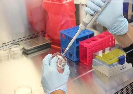 Modena Vaiolo delle scimmie, ci sono 14 casi «I vaccinati scelti dagli specialisti»