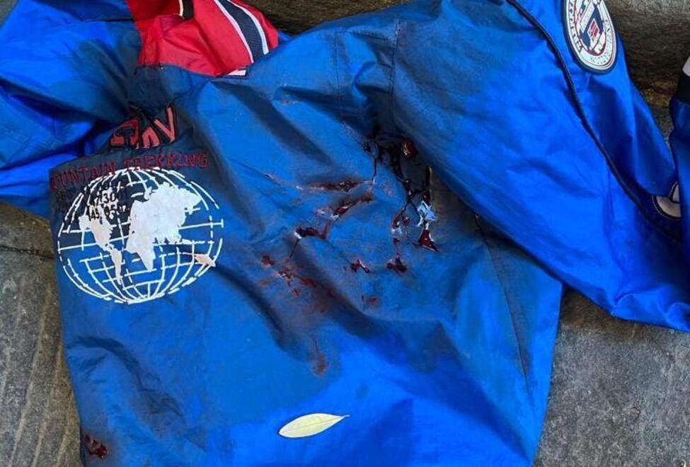 Sangue in piazza dei Cavalieri Amici aggrediti a colpi di bottiglia 
