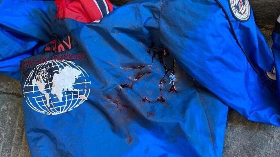 Sangue in piazza dei Cavalieri Amici aggrediti a colpi di bottiglia