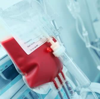 Morta a 68 anni per una trasfusione di sangue infetto: maxi risarcimento ai familiari