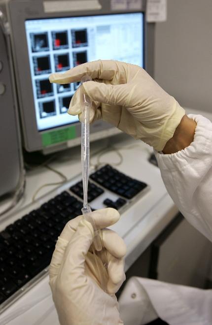 Il virus Ebola è lontano, dietro casa invece il Congo-Crimea 