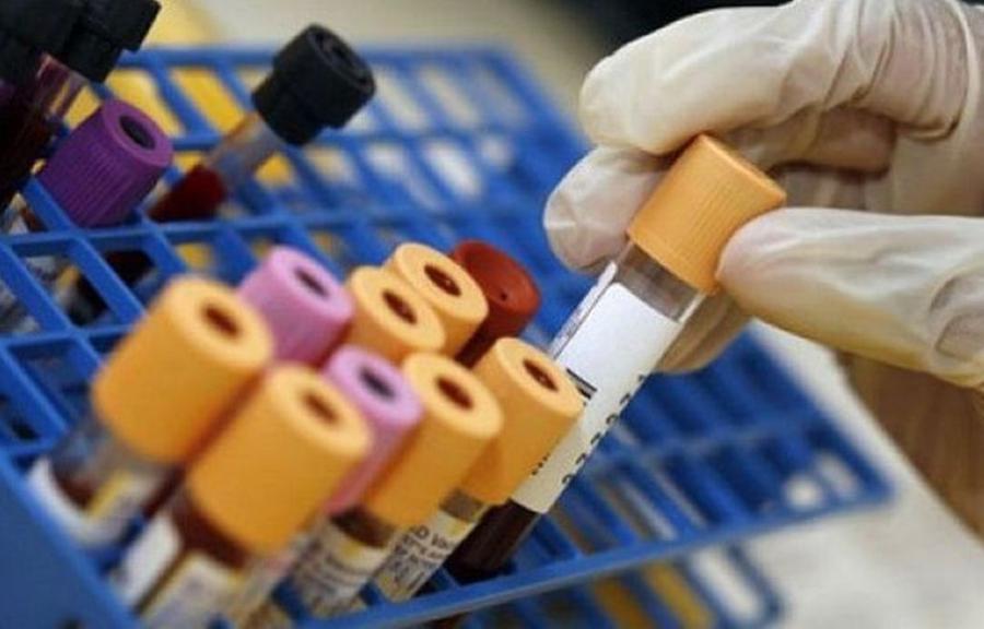 
	Dall'inizio della pandemia in Emilia Romagna i morti sono stati 18.071

