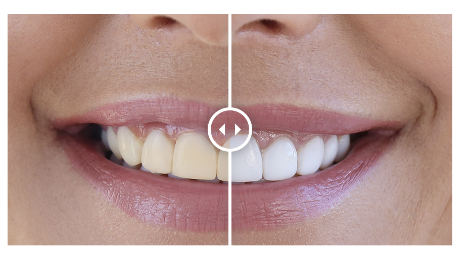Un’attenzione particolare alla salute dei denti senza trascurarne l’estetica