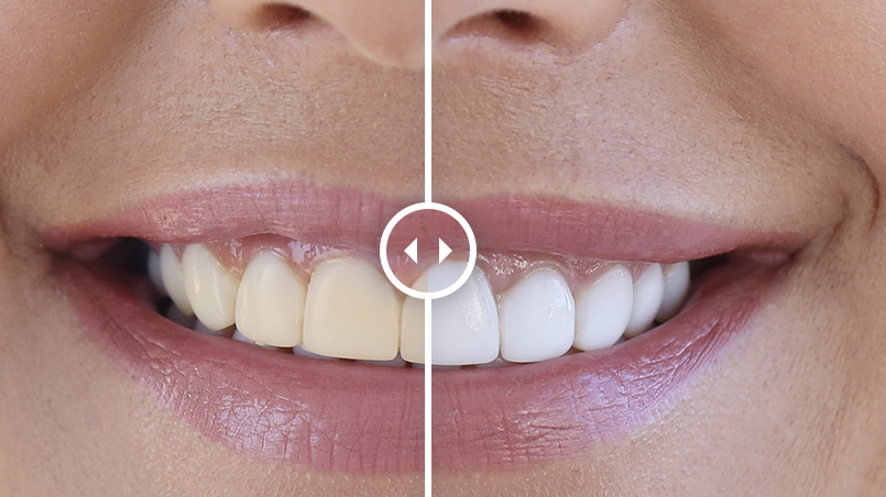 Un’attenzione particolare alla salute dei denti senza trascurarne l’estetica