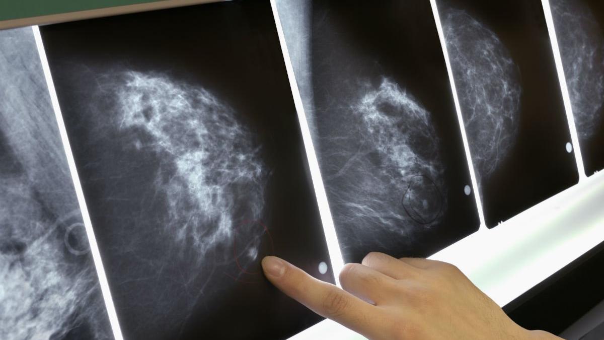 Ginecologia tallone d’Achille: puntuali solo sei visite su dieci