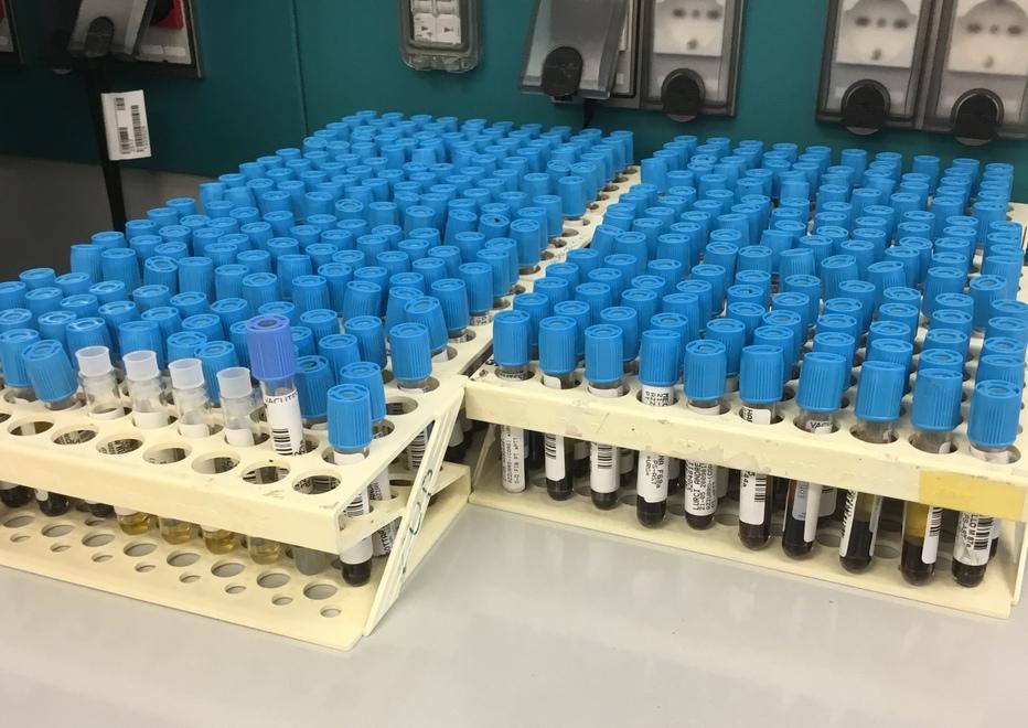 Nella foto provette in un laboratorio di analisi