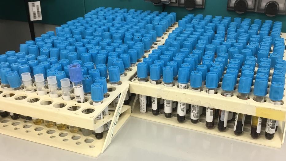 Nella foto provette in un laboratorio di analisi