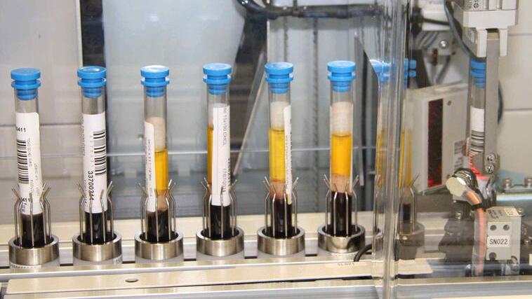 Le provette del laboratorio di analisi dell’ospedale di Prato