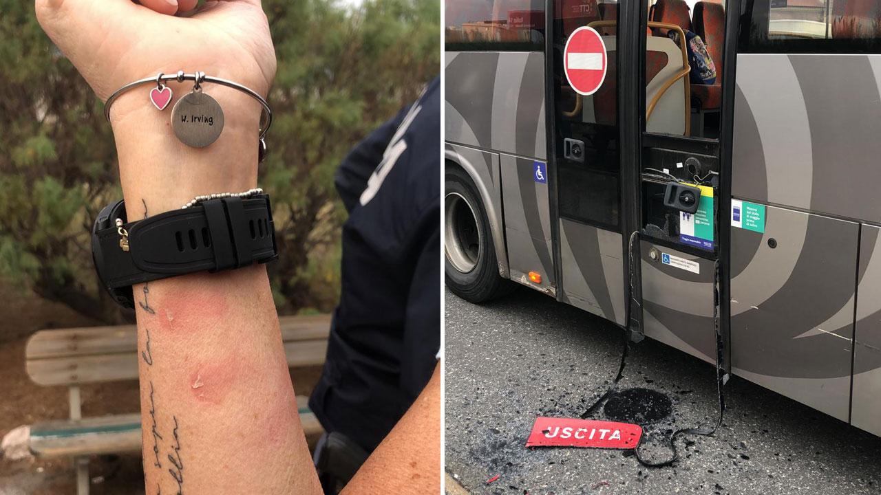I segni rimasti sul braccio della conducente e i danni causati al bus