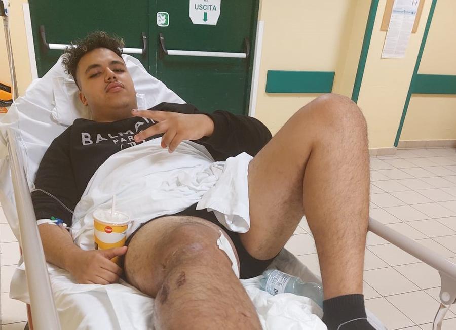 Investito dopo una lite in strada: 20enne in ospedale