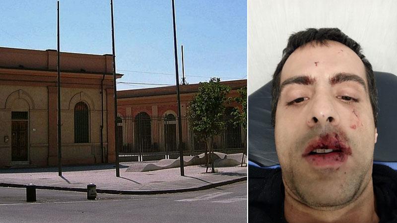 Pisa, sfregiato da un ladro in fuga: «Volevo solo aiutare un derubato»