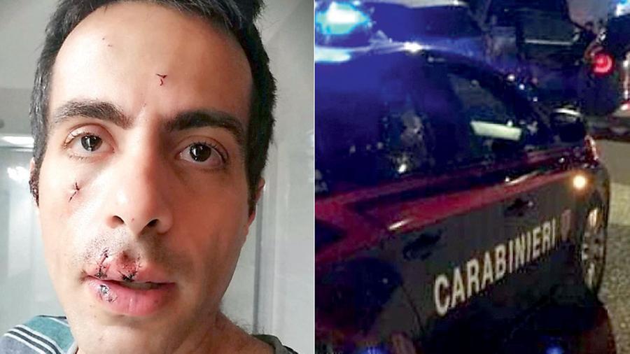 
	A sinistra il 36enne pisano dopo l'aggressione da parte della coppia di ladri; a destra una macchina dei carabinieri

