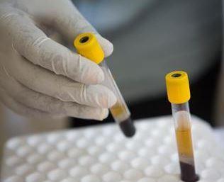 Ferrara, Aids: sono 11 i nuovi casi 670 i pazienti in terapia