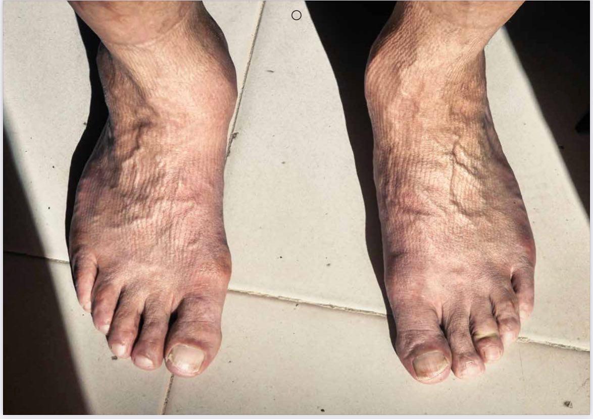 I piedi dell’ex bomber Protti si fanno calendario: già in vendita, i proventi all’Unicef