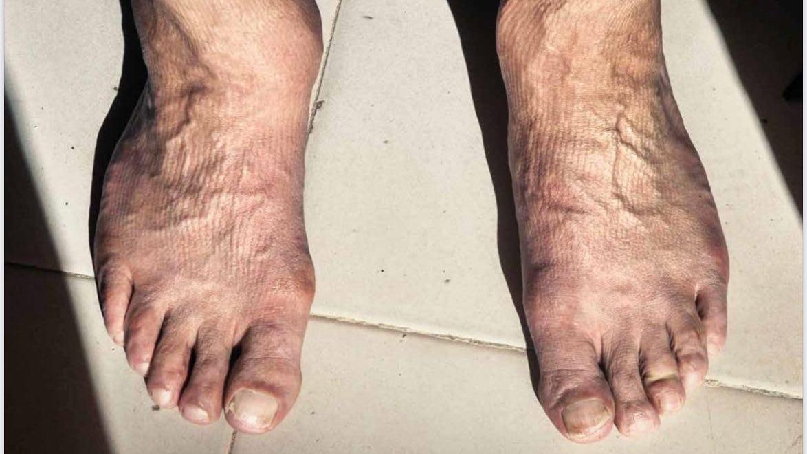 I piedi dell’ex bomber Protti si fanno calendario: già in vendita, i proventi all’Unicef