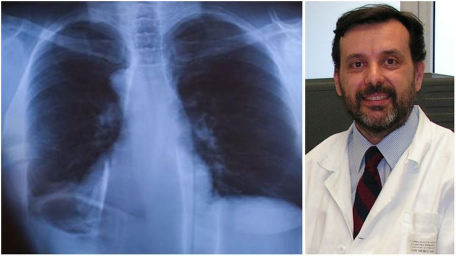 La salute dei polmoni: i consigli, le cure e la prevenzione