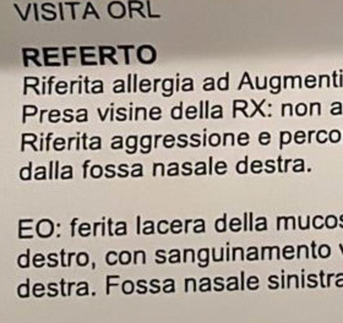Ferrara, «tardo al lavoro, il mio compagno con una testata mi rompe il naso»
