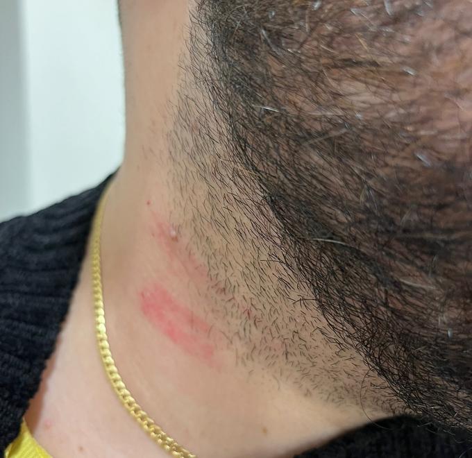 Peccioli, accusa il sindaco di aggressione: l’audio c’è, ma non si sente niente. Il fruscio copre il momento
