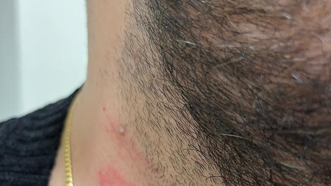 Peccioli, accusa il sindaco di aggressione: l’audio c’è, ma non si sente niente. Il fruscio copre il momento