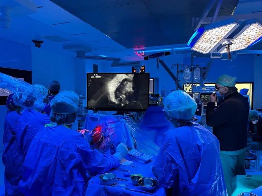 Careggi prima in Toscana a usare l’esoscopio 3D per operare il cervello