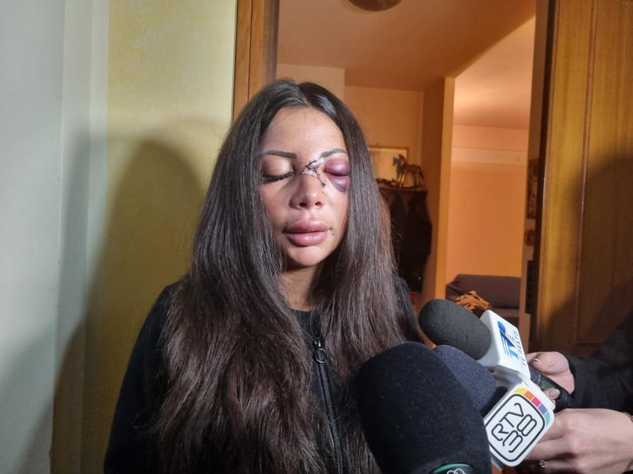 Prato, aggredita dai sicari nell’androne di casa: «Mi volevano sfregiare, ho un sospetto sul “mandante” e mi fa male» – Video
