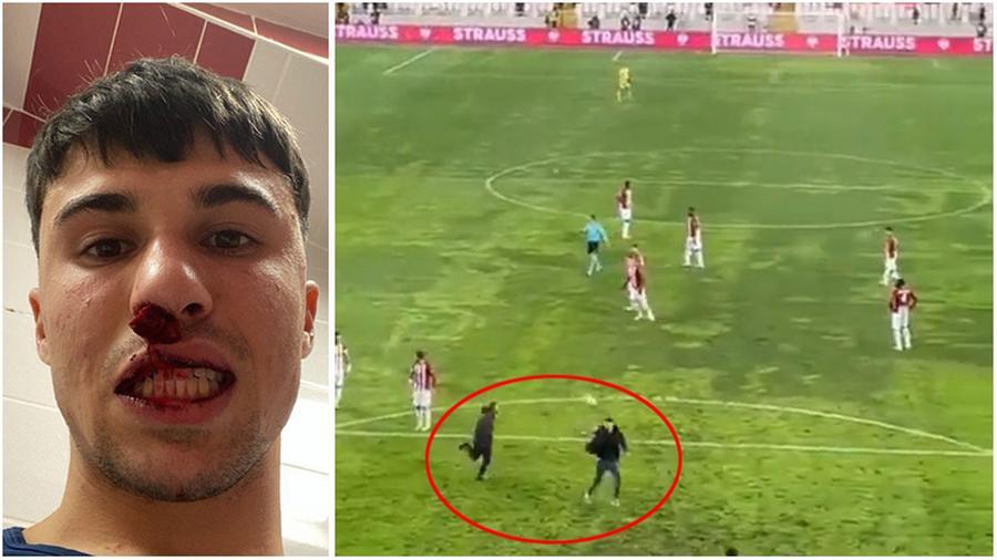 Fiorentina- Sivasspor, aggredito con un pugno il centrocampista Bianco. I media turchi: «Due arresti»