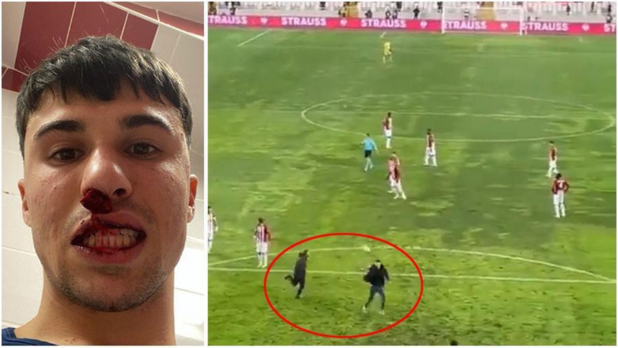 Fiorentina- Sivasspor, aggredito con un pugno il centrocampista Bianco. I media turchi: «Due arresti»