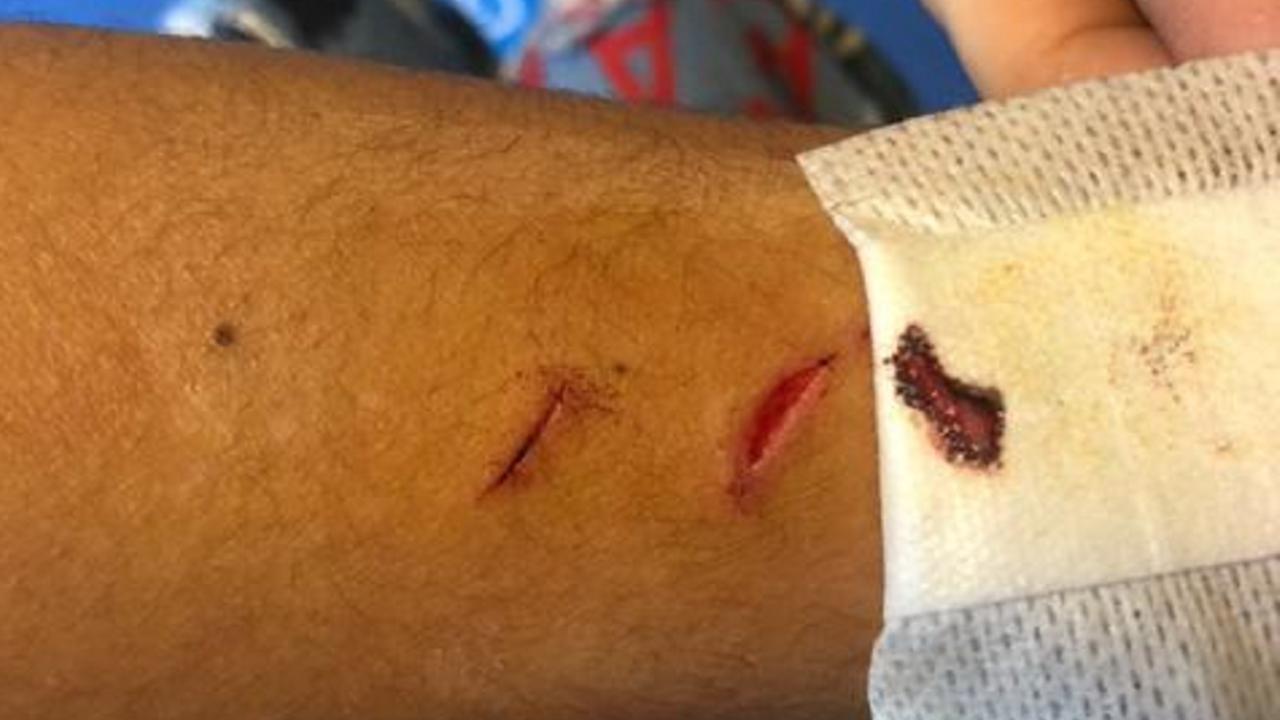 Accoltellato e rapinato a 13 anni, la rabbia del padre: «Corea un quartiere pericoloso»