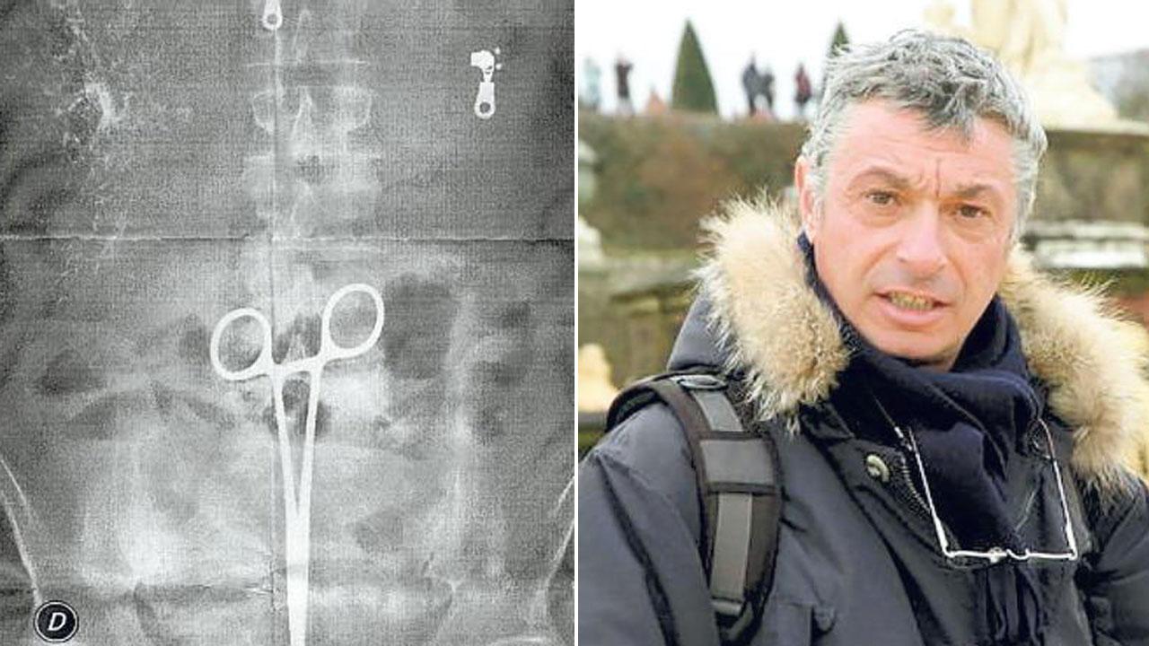 Stefano Miniati, di Massa che non morì per la pinza dimenticata ma che visse mesi di dolori e che in seguito è deceduto per una neoplasia