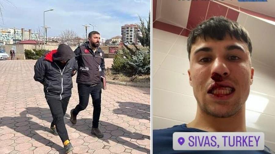 Pugno a Bianco, arrestato il tifoso: adesso si attende la decisione Uefa