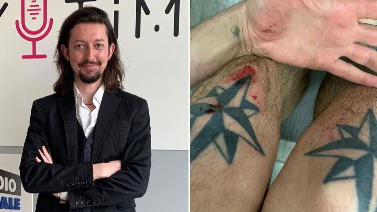 Daniel Di Martino e le ferite riportate dopo la rapina per le vie di Milano