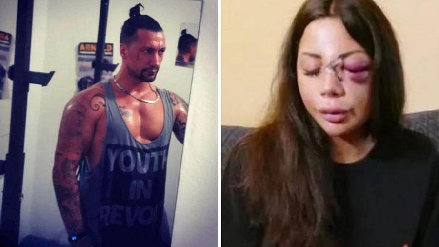 Assolda due persone per sfregiare la ex, il dolore della ragazza: «Speravo che non fosse lui»