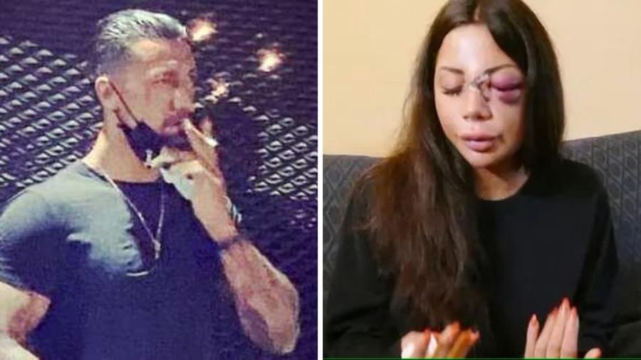 Assolda due persone per sfregiare l’ex: è caccia al secondo picchiatore, il nome lo faranno i complici