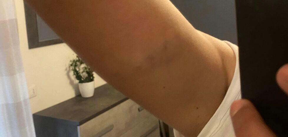 Massa, aggredita nella sua auto da un ciclista di passaggio: «Mi ha anche insultata»