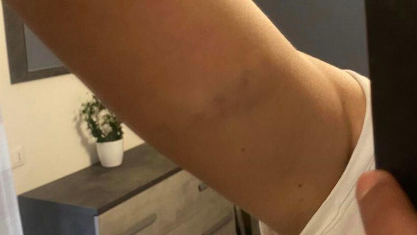 Massa, aggredita nella sua auto da un ciclista di passaggio: «Mi ha anche insultata»