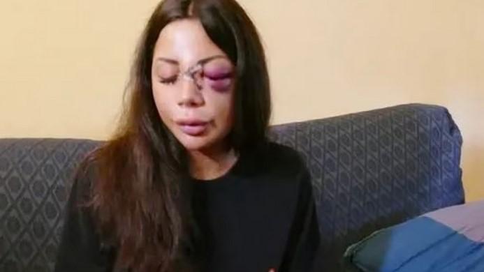 Barista di Prato fatta picchiare dall’ex, uno degli aggressori è andato in vacanza coi soldi del pestaggio
