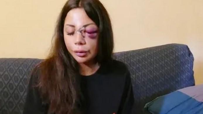 Barista di Prato fatta picchiare dall’ex, uno degli aggressori è andato in vacanza coi soldi del pestaggio