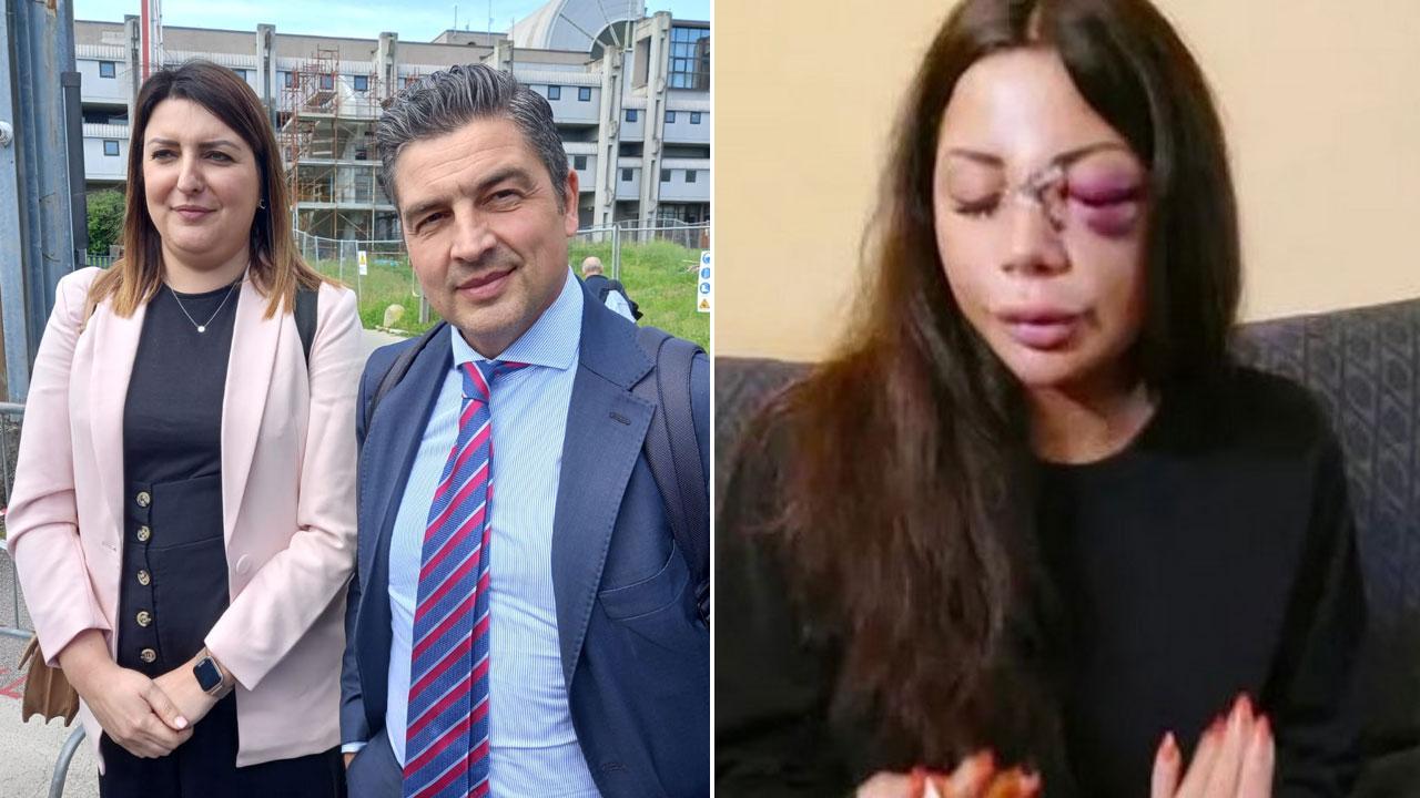Gli avvocati Alessandra Mattei e Antonio Bertei che difendono Kevin Mingoia, nella foto a destra i segni del pestaggio sul volto di Martina Mucci