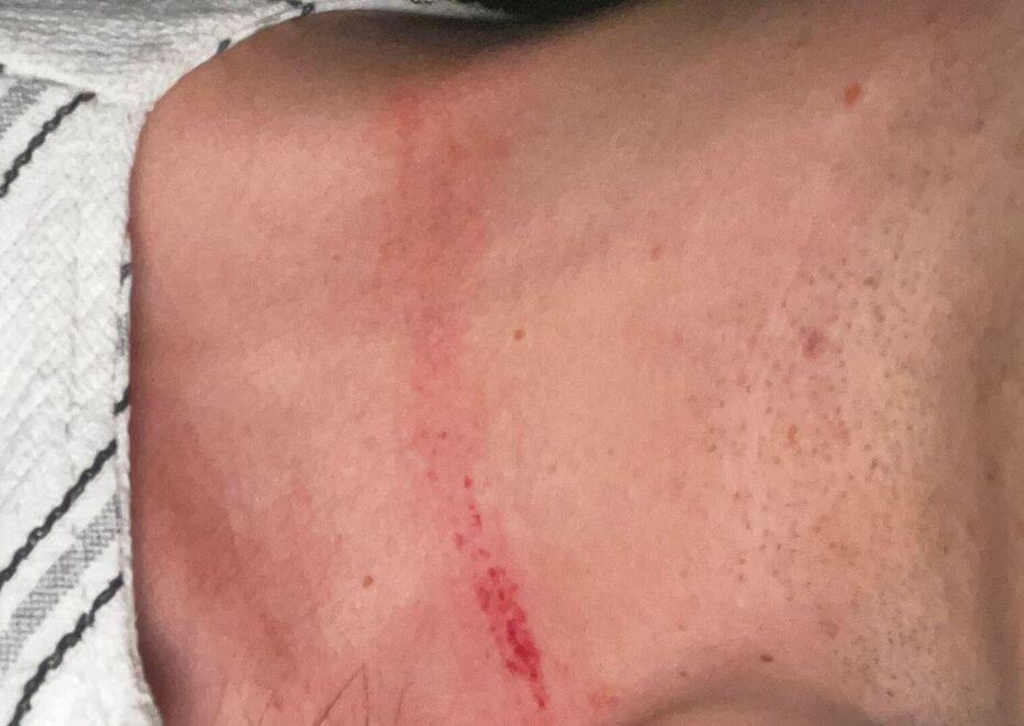 Formigine, scippato della collana alla festa: «Tre strattoni da dietro ed è sparita»