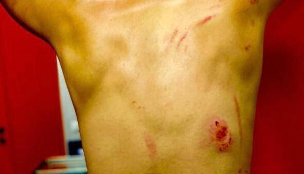 Pisa, reagisce al morso di un cane e viene picchiato: coppia denunciata per lesioni aggravate 