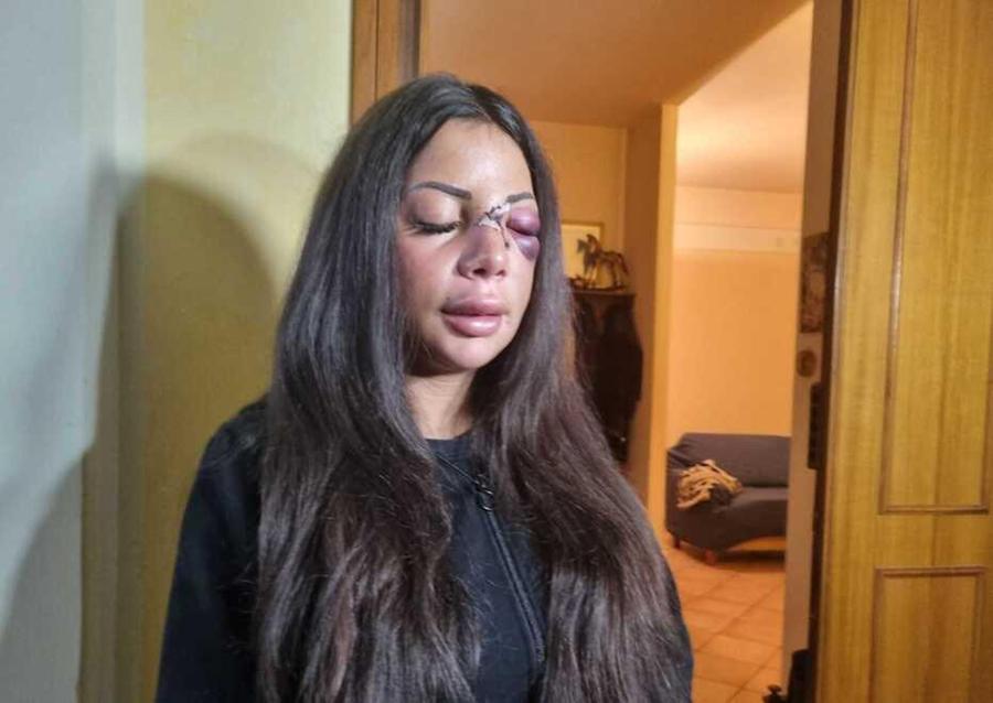 Prato, aggressione a Martina: indagata la fidanzata dell’ex