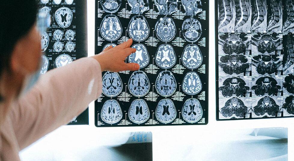 Ospedale Cisanello, in neurochirurgia i tempi sono azzerati. Ecco come ci sono riusciti