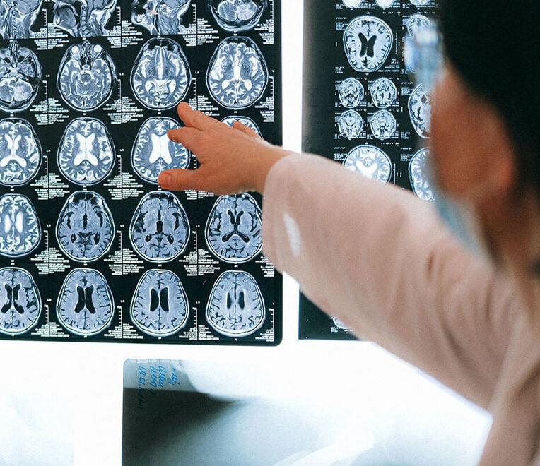 Lucca, un 32enne salvato da una malformazione cerebrale. «Nel privato pochi operano, troppi i rischi»