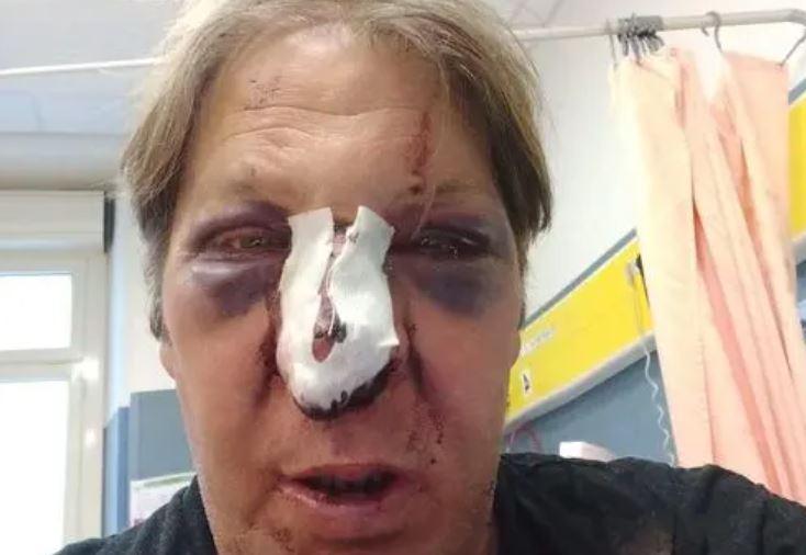 Cagliari, cerca di intervistare una cantante napoletana: giornalista pestato