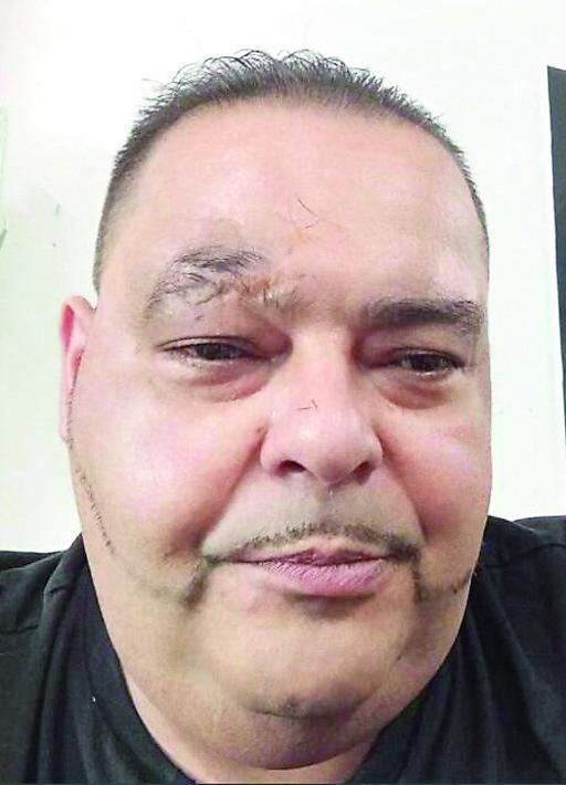 Accosta l’auto, si china sul volante e muore per un malore a 50 anni