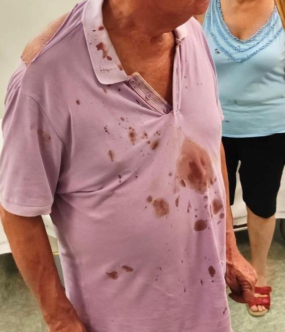 Maranello, parla l'imprenditore rapinato: «Picchiati a sangue e imbavagliati. Erano ex militari, pronti a uccidere»<br type="_moz" />
