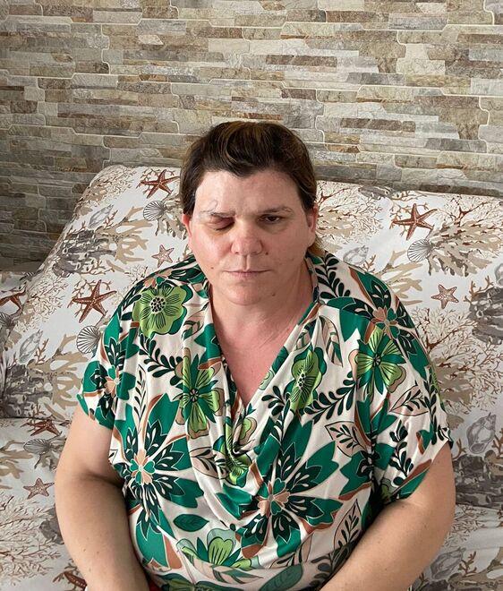 La donna infiocinata a Golfo Aranci: «Ho tanta paura di quell’uomo, potrebbe farci ancora del male»