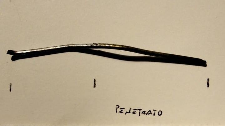 Novi. «Un filo di ferro conficcato nel collo: sono vivo per un solo millimetro»<br>