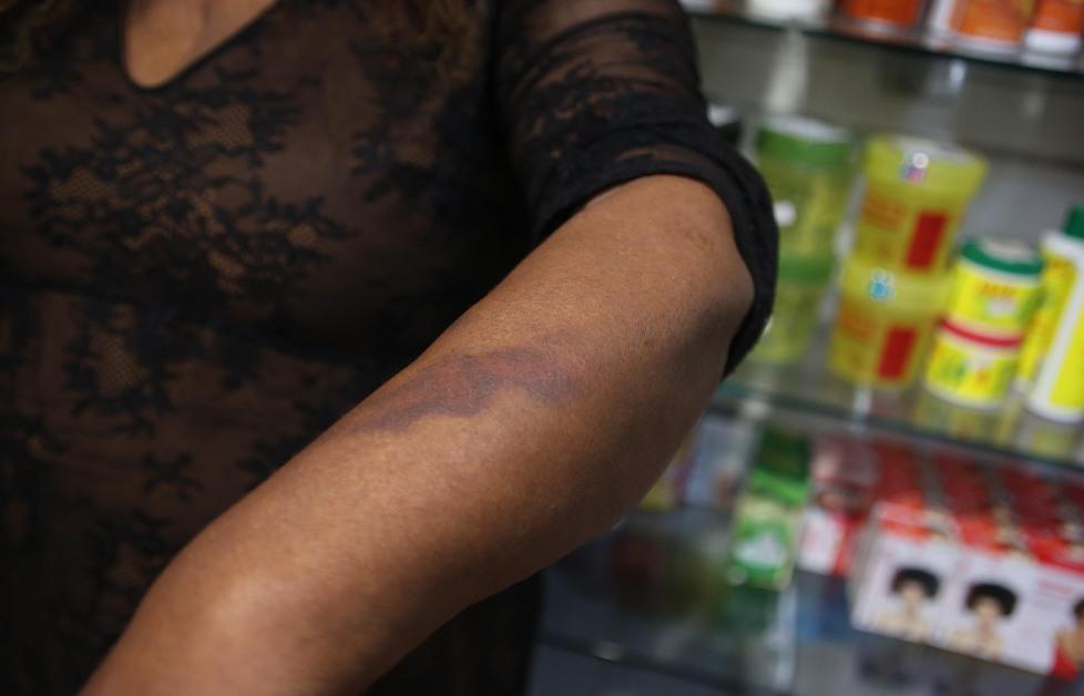 Negoziante pestata con calci e pugni «Quella cliente sembrava una furia» 